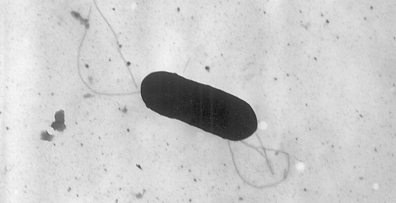 An oval, pill-shaped dark blob sits in the centre of a microscope image. Small tendrils snake off of it in a couple places.